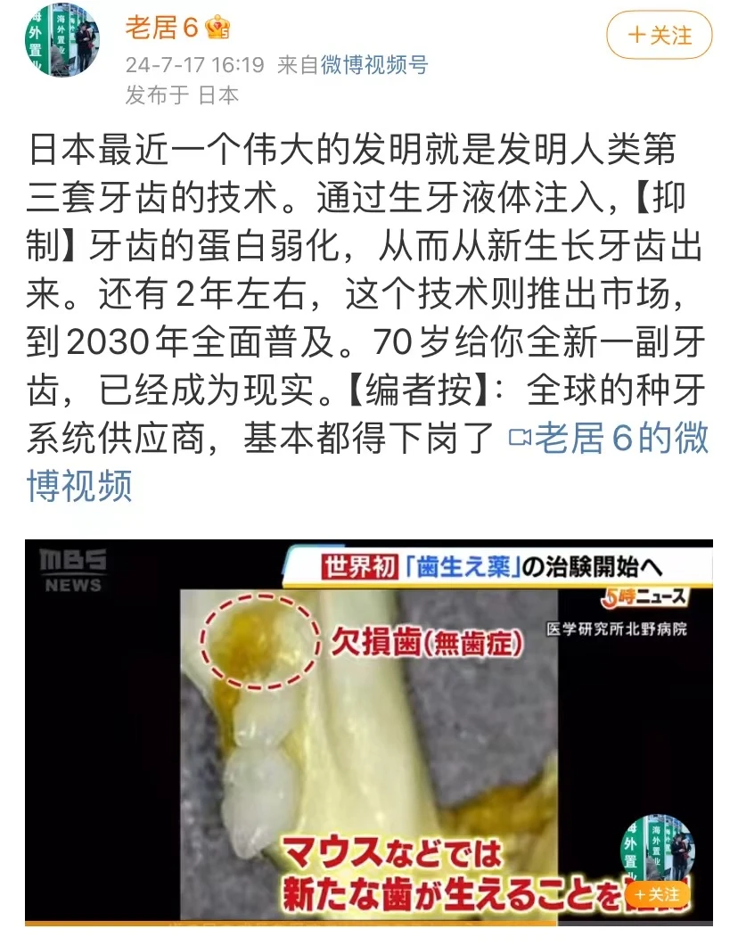 这个好！期待可以早日换上一口新牙齿 - 图1